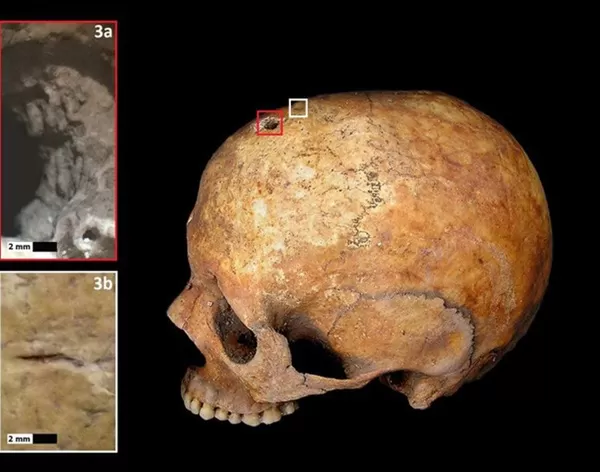 O mistério do esqueleto de 1.300 anos dando à luz em um caixão e a explicação do fenômeno que faz estremecer muita gente - 3